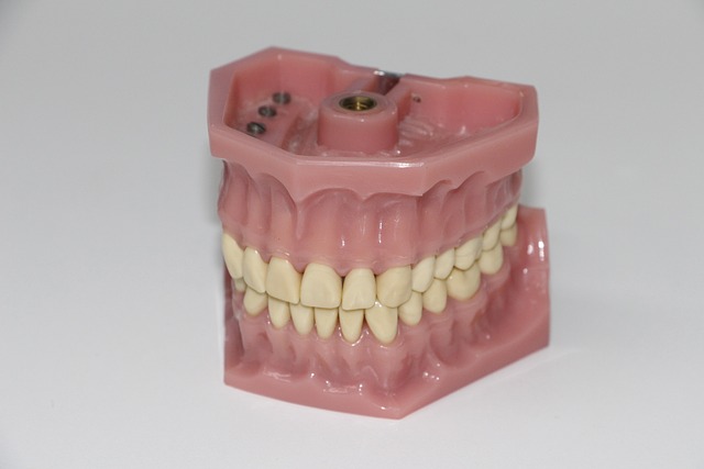 Erstatning af manglende tænder: Hvordan tandproteser kan forbedre din livskvalitet